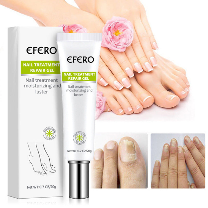 Nail Treatment Serum Nail Foot Nail Fungus Removal Gel Anti Infection Onychomycosis Nail Repair Cream Feet Care