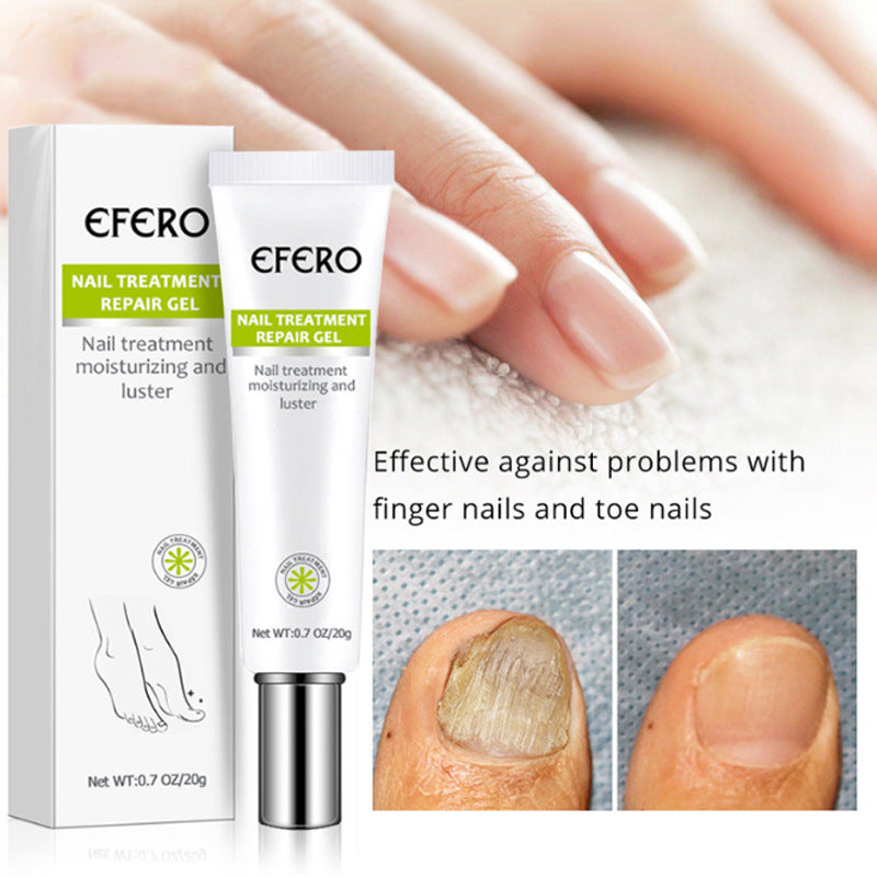 Nail Treatment Serum Nail Foot Nail Fungus Removal Gel Anti Infection Onychomycosis Nail Repair Cream Feet Care