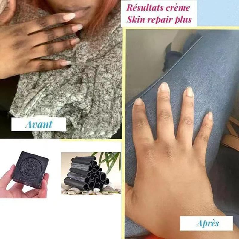 African Nigerian Whitening Soap Vaginal Handmade Soap Dark Bikini Line Women Vaginal Skin Cleansing Rswank