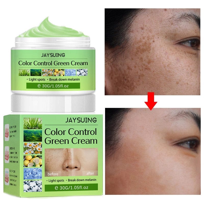 Whitening Freckles Cream Remove Melasma Dark Spots Lighten Melanin Melasma Remover Moisturizing Brighten Face Skin Care 30ML Rswank