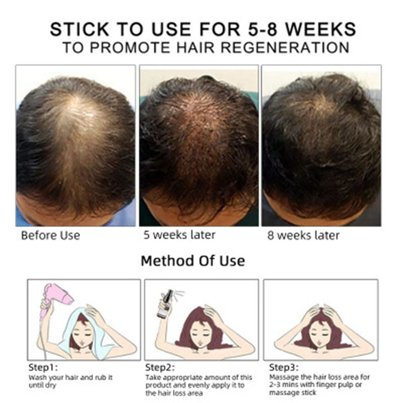 Hair Growth Oil Hair Growth Oil Oem Hair Care Essential Oil - Rswank