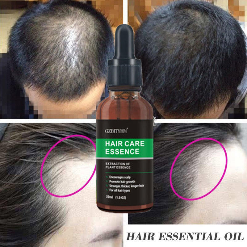 Hair Growth Oil Hair Growth Oil Oem Hair Care Essential Oil - Rswank