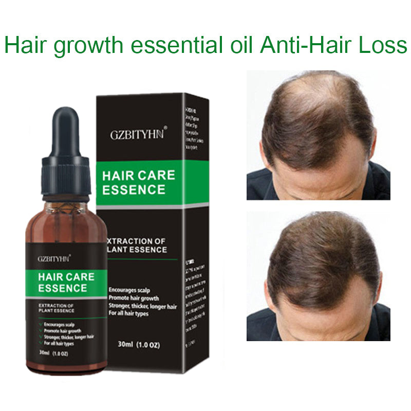 Hair Growth Oil Hair Growth Oil Oem Hair Care Essential Oil - Rswank