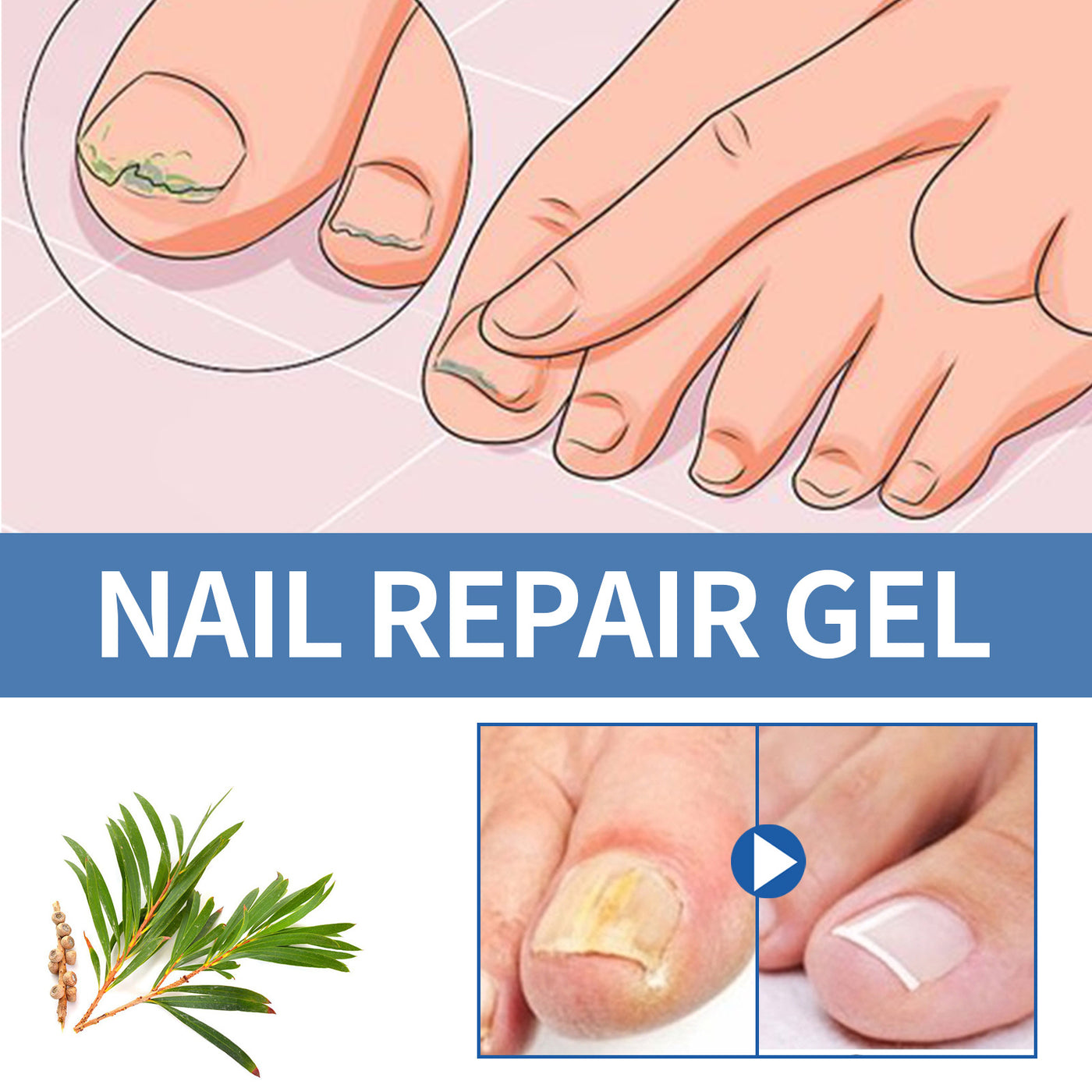 Nail Fungus Care Gel Repair