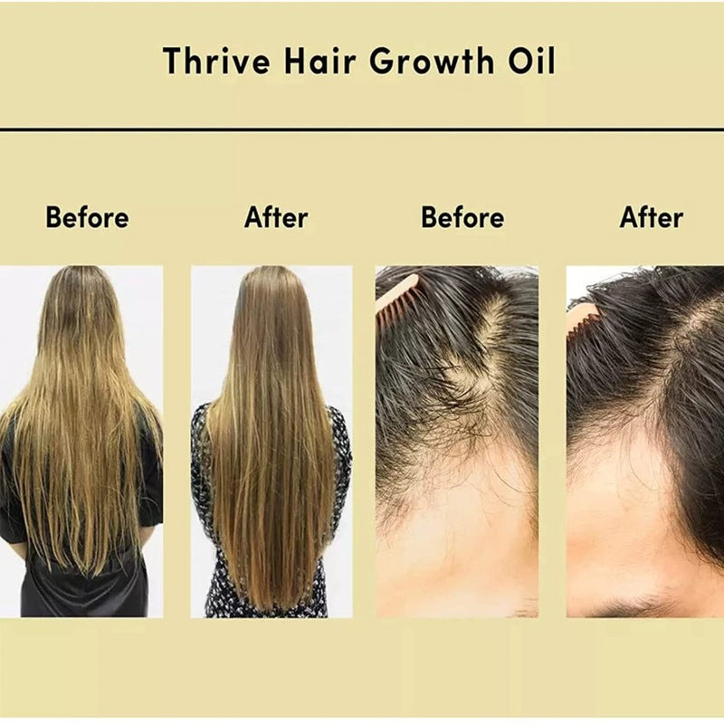 Rosemary Soft Hair Care Essential Oil - Rswank