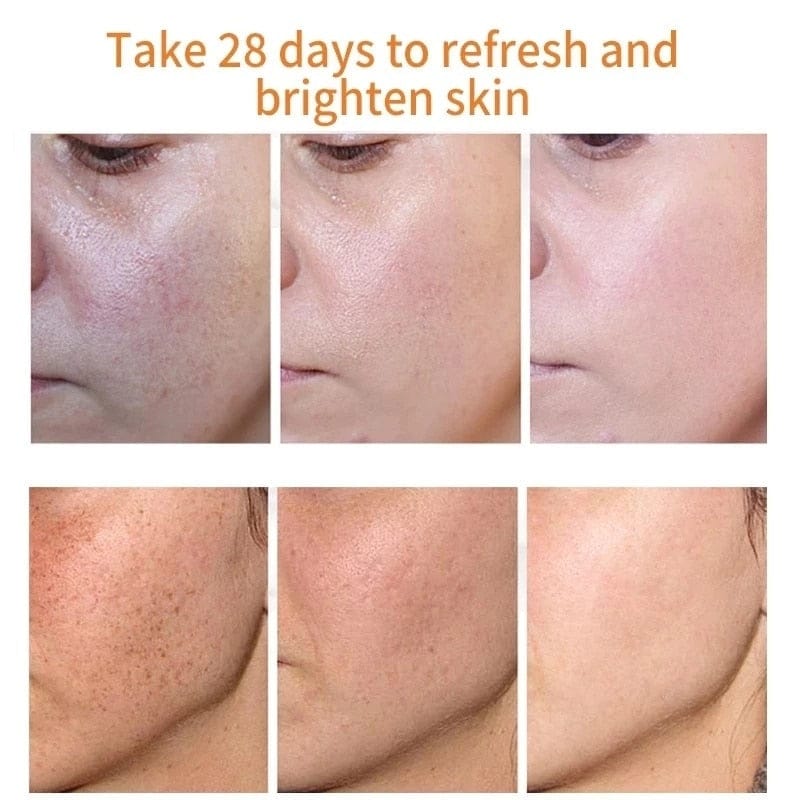 Whitening Freckles Cream Remove Melasma Dark Spots Lighten Melanin Melasma Remover Moisturizing Brighten Face Skin Care 30ML Rswank